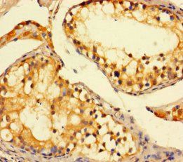 SAT1 Antibody