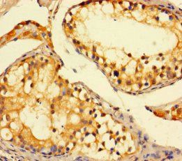 Diamine acetyltransferase 1 antibody