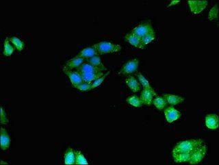 DIAPH3 Antibody