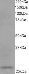 Goat anti-Dicarbonyl Reductase Antibody