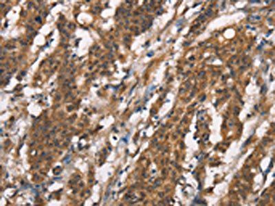 DICER1 Antibody