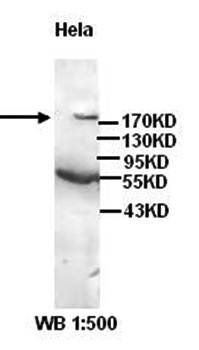 Dicer1 Rabbit Polyclonal Antibody