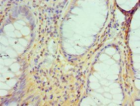 DIDO1 Antibody