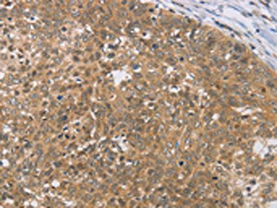 DIDO1 Antibody