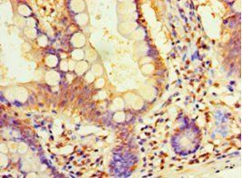 DIMT1 Antibody