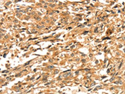 DIRAS1 Antibody