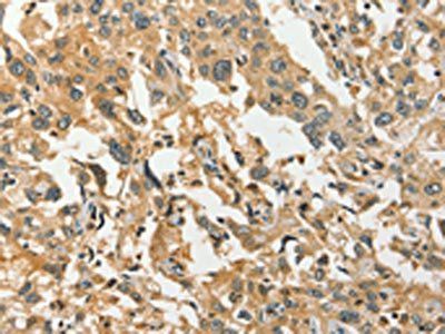 DIRAS1 Antibody