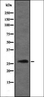 DIRAS3 antibody