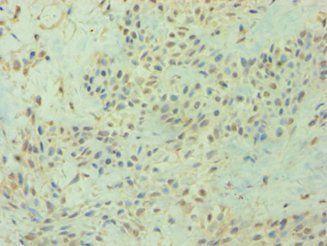DIRAS3 Antibody