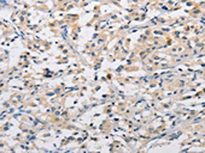 DIRAS3 Antibody