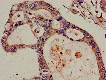 DIS3 Antibody