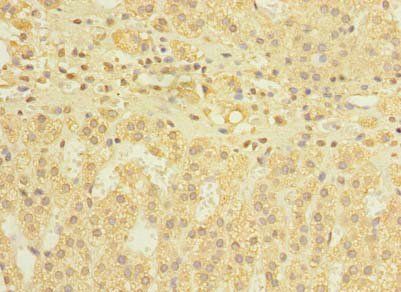 DIS3L Antibody