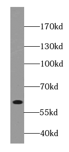 DISC1-long-specific antibody