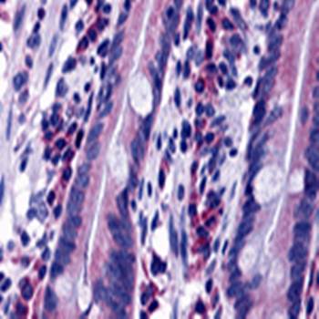 DISP2 Antibody