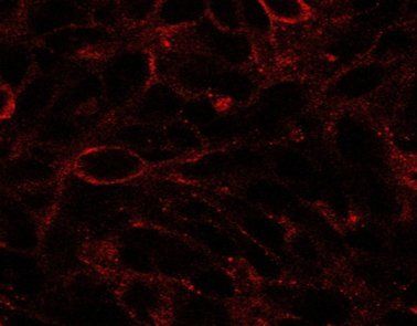Goat anti-Dispatched homolog 1 Antibody