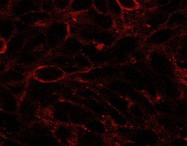 Dispatched homolog 1 antibody