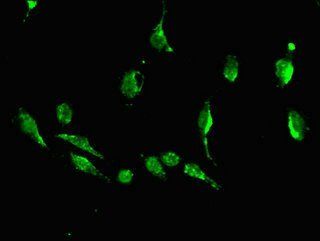 DKK1 antibody