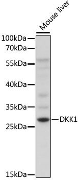 DKK1 antibody