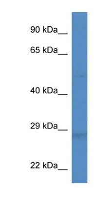 Dkk2 antibody