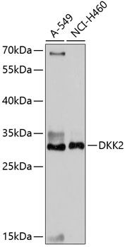 DKK2 antibody