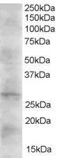 DKK2 antibody