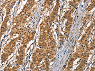 DKK3 Antibody