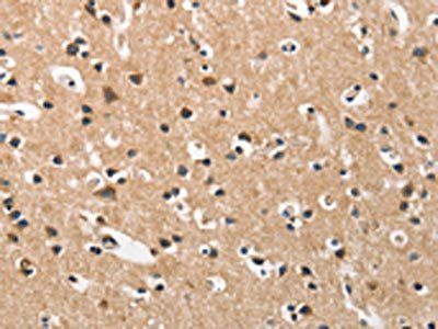DKK3 Antibody