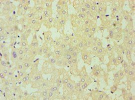 DKK4 Antibody