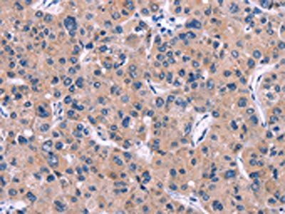 DKK4 Antibody