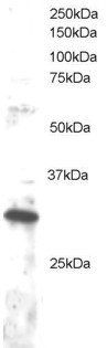 Goat anti-DKK4 Antibody