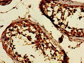 DKKL1 Antibody