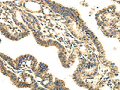 DLAT Antibody