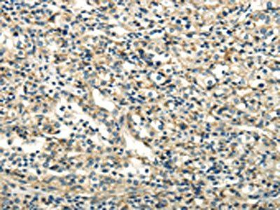 DLAT Antibody