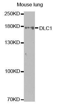 DLC1 antibody