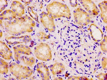 DLD Antibody
