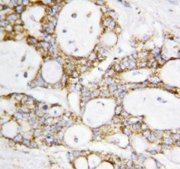 Anti-Lipoamide Dehydrogenase/DLD Antibody