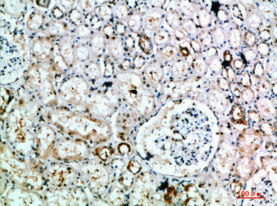 DLEU7 Antibody