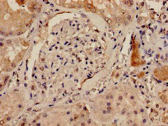 DLG1 Antibody