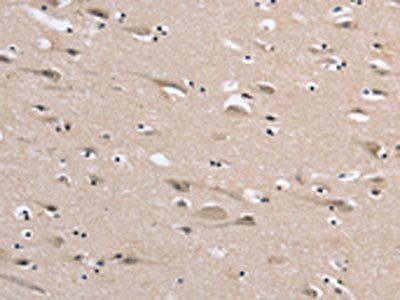 DLG2 Antibody