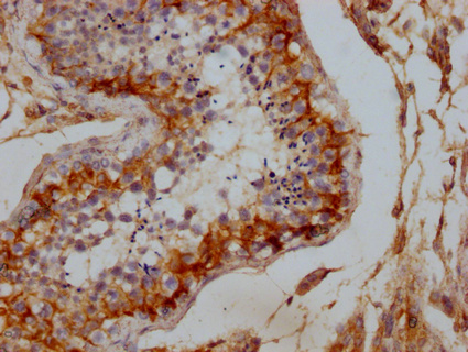 DLG4 Antibody