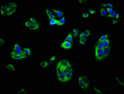 DLG5 antibody