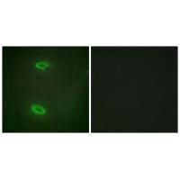 DLGAP1 Antibody
