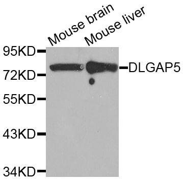DLGAP5 antibody