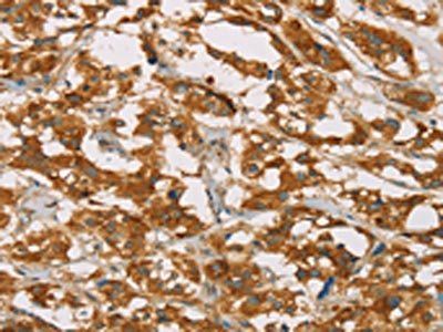 DLL4 Antibody