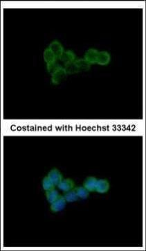 DLST antibody [N3C3]