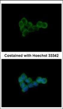 DLST antibody