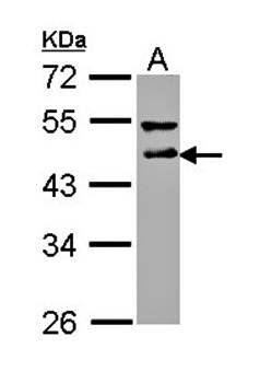 DLST antibody