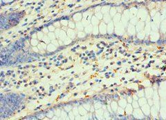 DLX3 Antibody