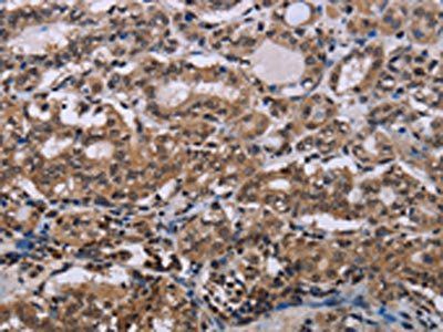 DLX4 Antibody