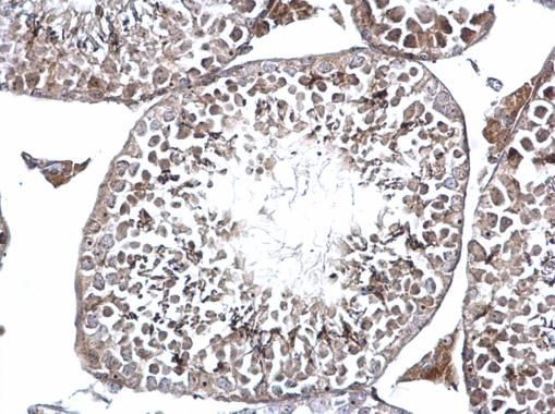 DMC1 antibody [N1C1]